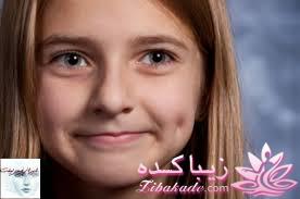 زیباترین معلولیت جسمی